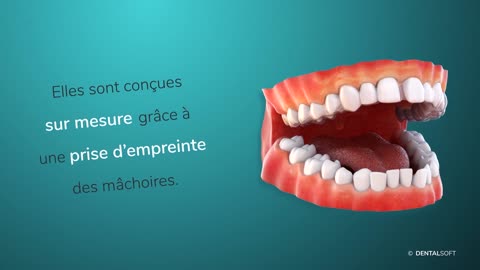 Gouttières occlusales